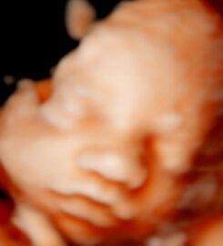 Ecos5D Majadahonda Especialistas en ecografías 5D y 8k