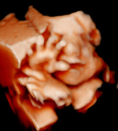 Ecos5D Majadahonda Especialistas en ecografías 5D y 8k