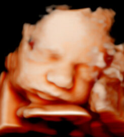 Ecos5D Majadahonda Especialistas en ecografías 5D y 8k