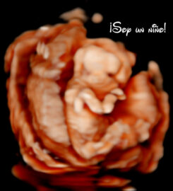 Ecos5D Majadahonda Especialistas en ecografías 5D y 8k