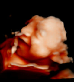 Ecos5D Majadahonda Especialistas en ecografías 5D y 8k